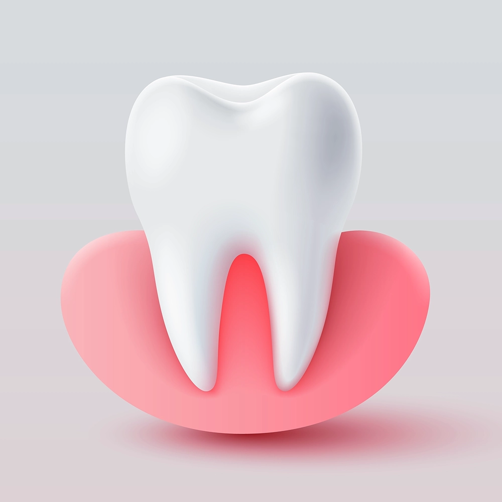 A 3D visualization of a tooth set in red, inflamed gums, highlighting the critical nature of gum disease that could lead to tooth loss if untreated.