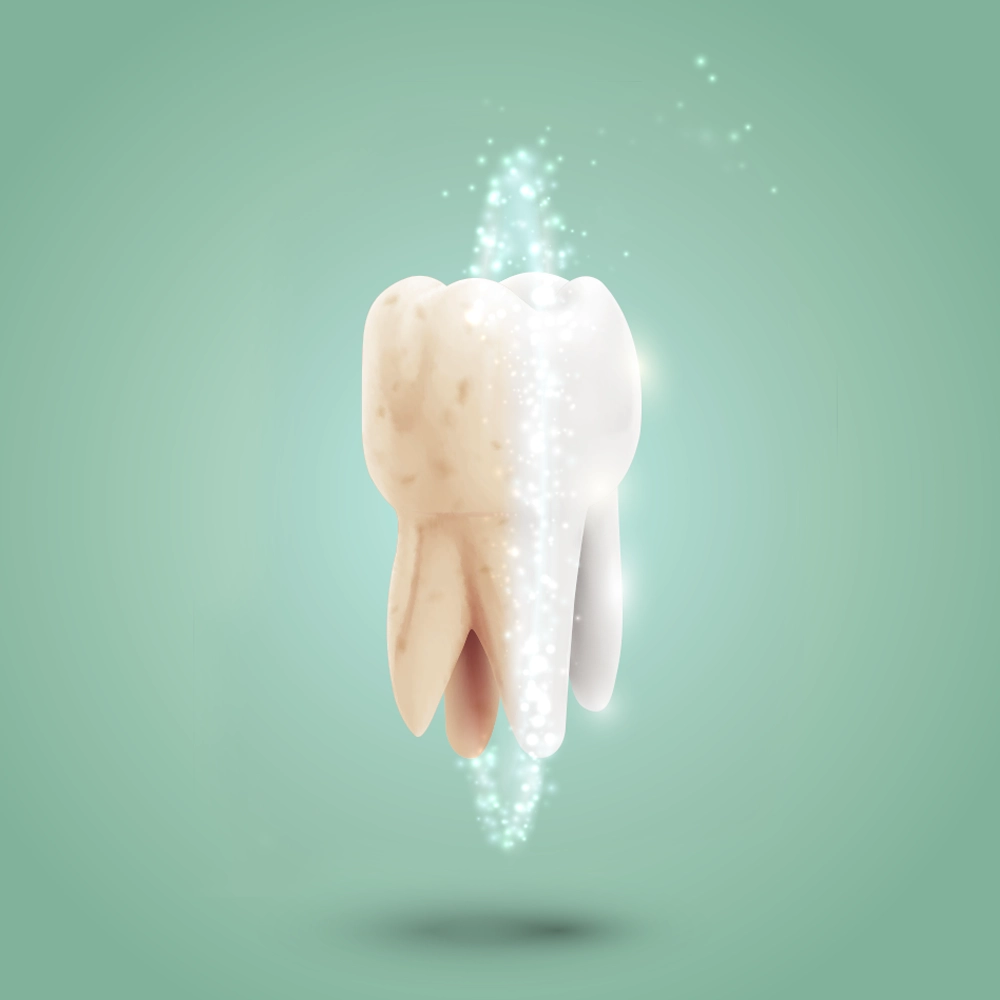 A digitally created 3D illustration showing the transformation of a tooth from discolored to bright white. The tooth is surrounded by sparkling effects, symbolizing the effectiveness of professional teeth whitening.