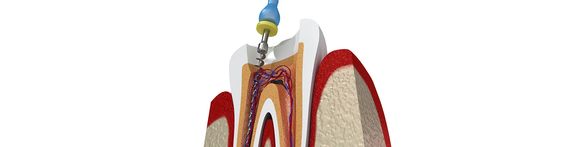 rendering of a tooth showing internal anatomy