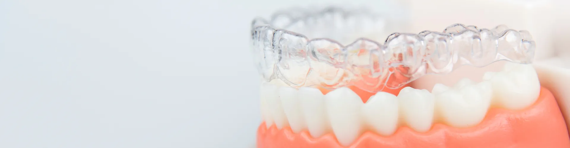 Invisalign on example teeth