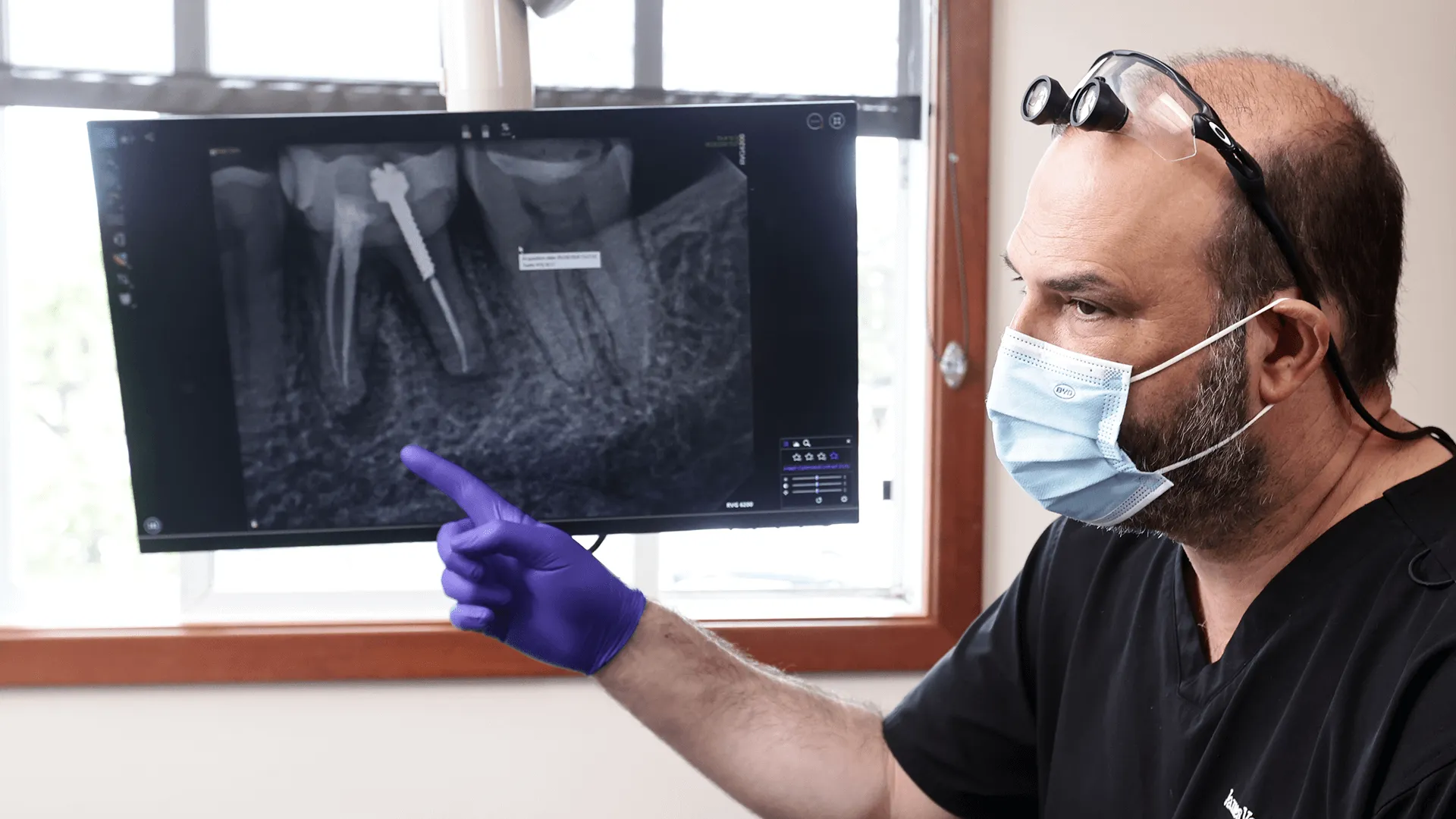 Scene in a dental office showing a male dentist in black scrubs and blue surgical mask analyzing a dental X-ray on a monitor, pointing at the image.