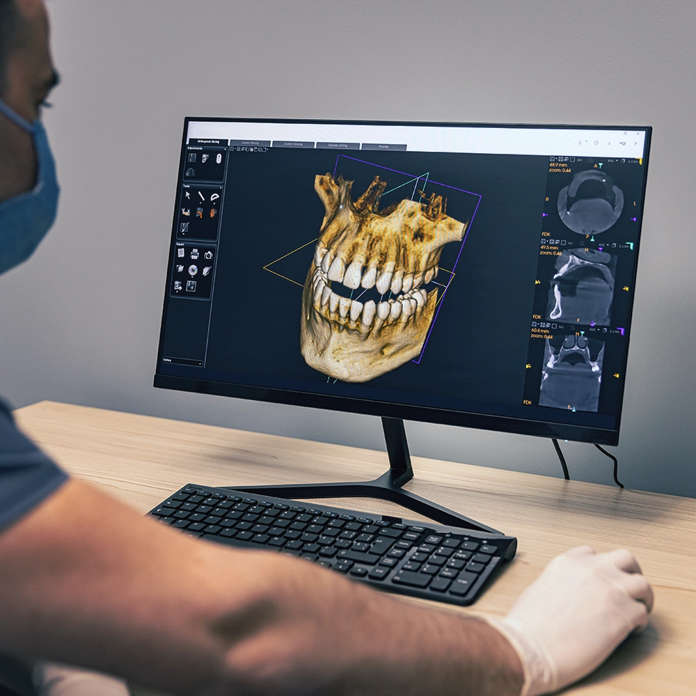  A dental professional in scrubs and surgical mask examines a complex 3D dental scan displayed on a large monitor, indicative of advanced dental diagnostic technology.